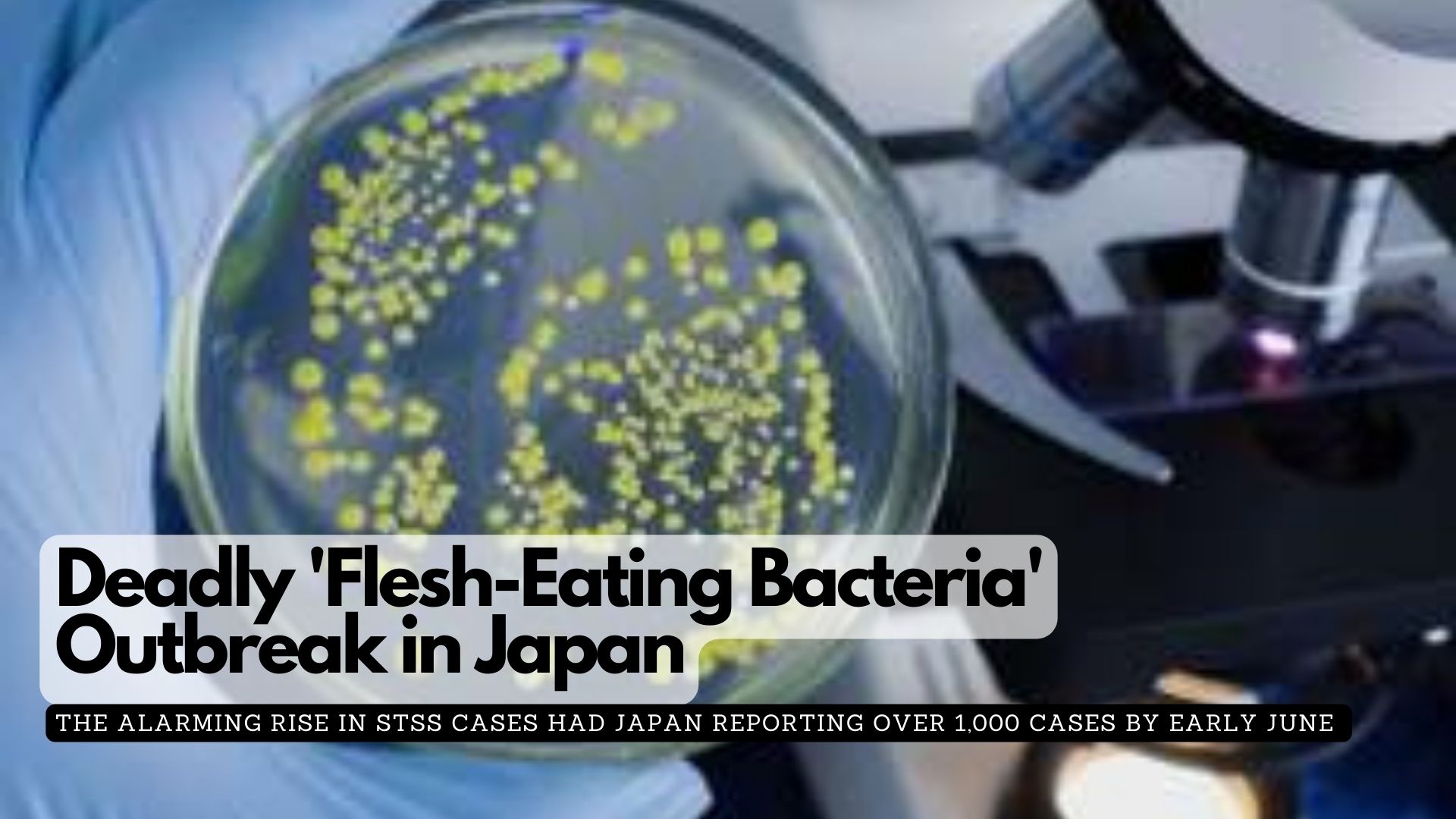 Deadly 'Flesh-Eating Bacteria' Outbreak in Japan