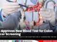 FDA Approves New Blood Test for Colon Cancer Screening