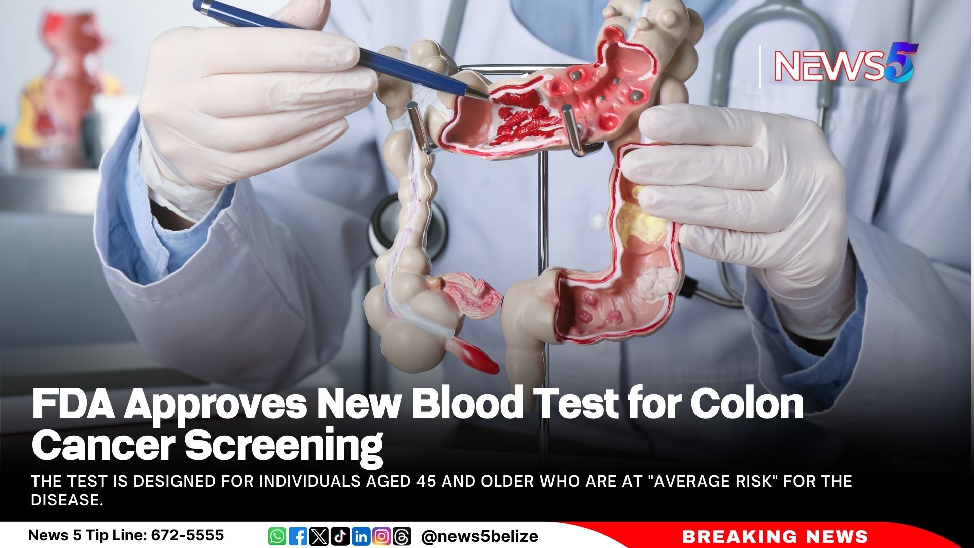 FDA Approves New Blood Test for Colon Cancer Screening