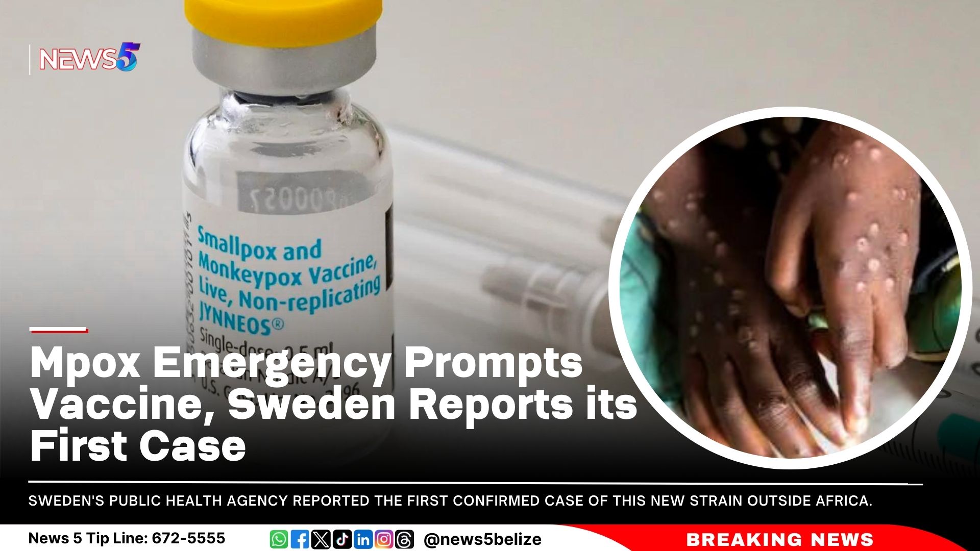 Mpox Emergency Prompts Vaccine, Sweden Reports its First Case