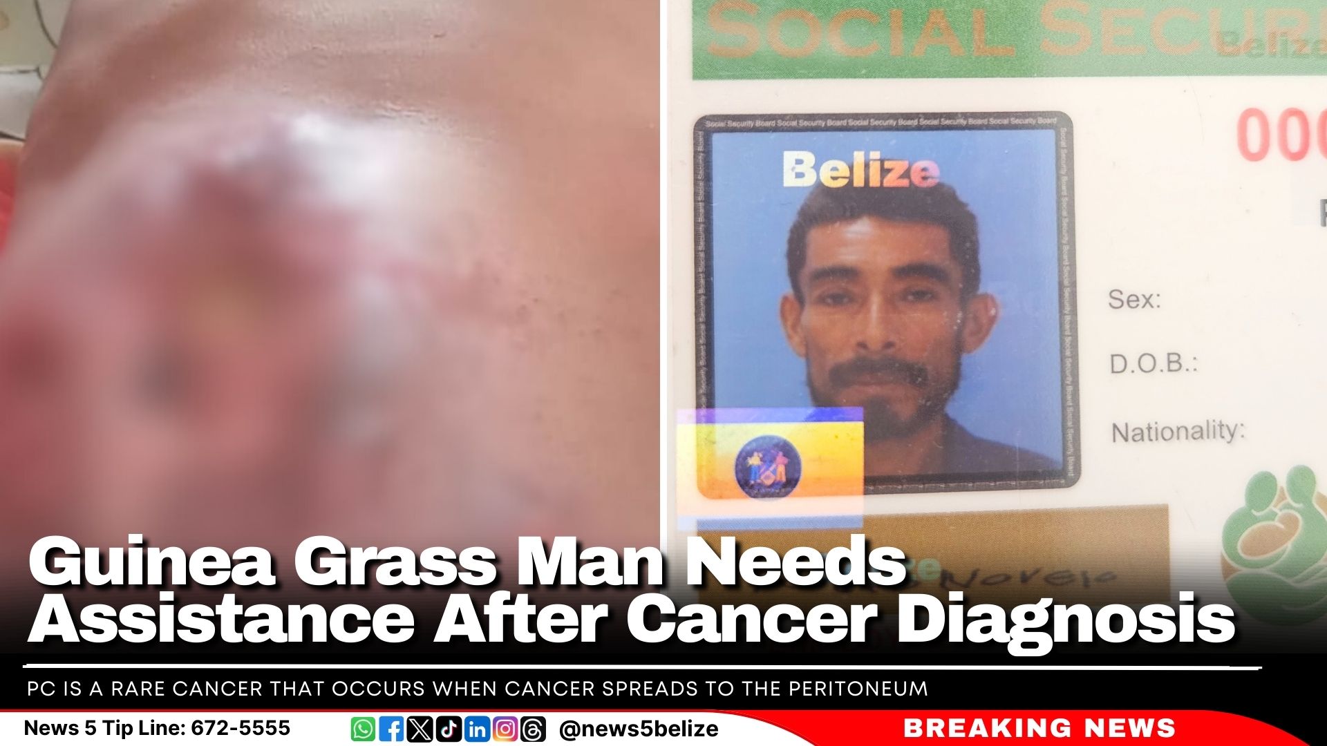  Guinea Grass Man Needs Assistance After Cancer Diagnosis