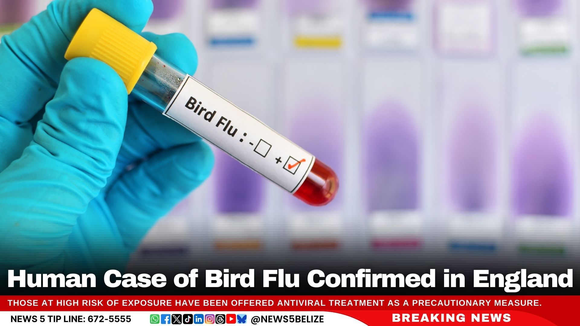 Human Case of Bird Flu Confirmed in England