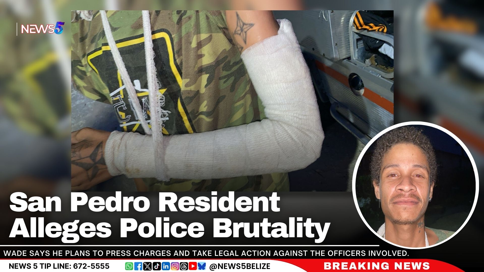 San Pedro Resident Alleges Police Brutality