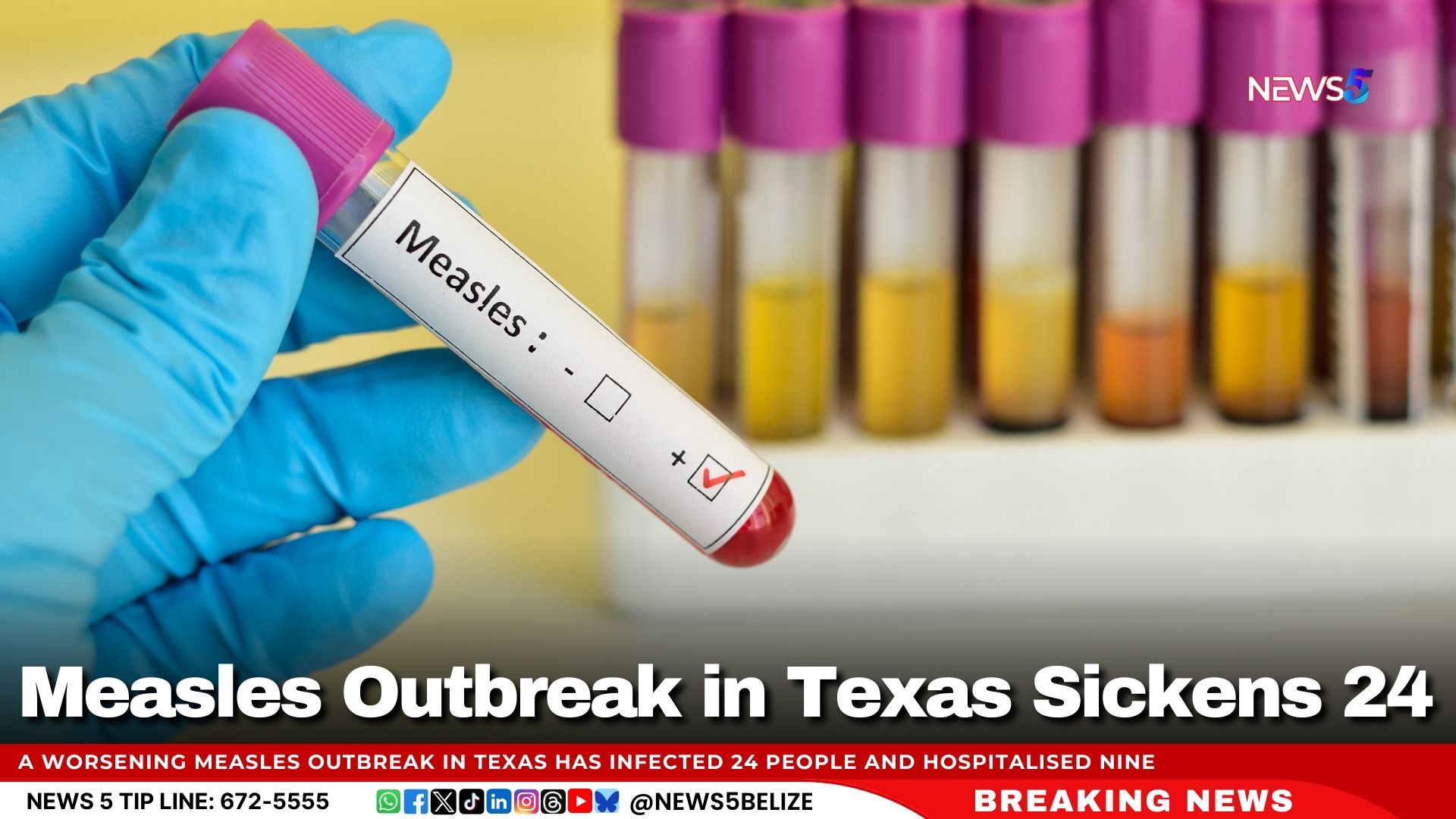 Measles Outbreak in Texas Sickens 24