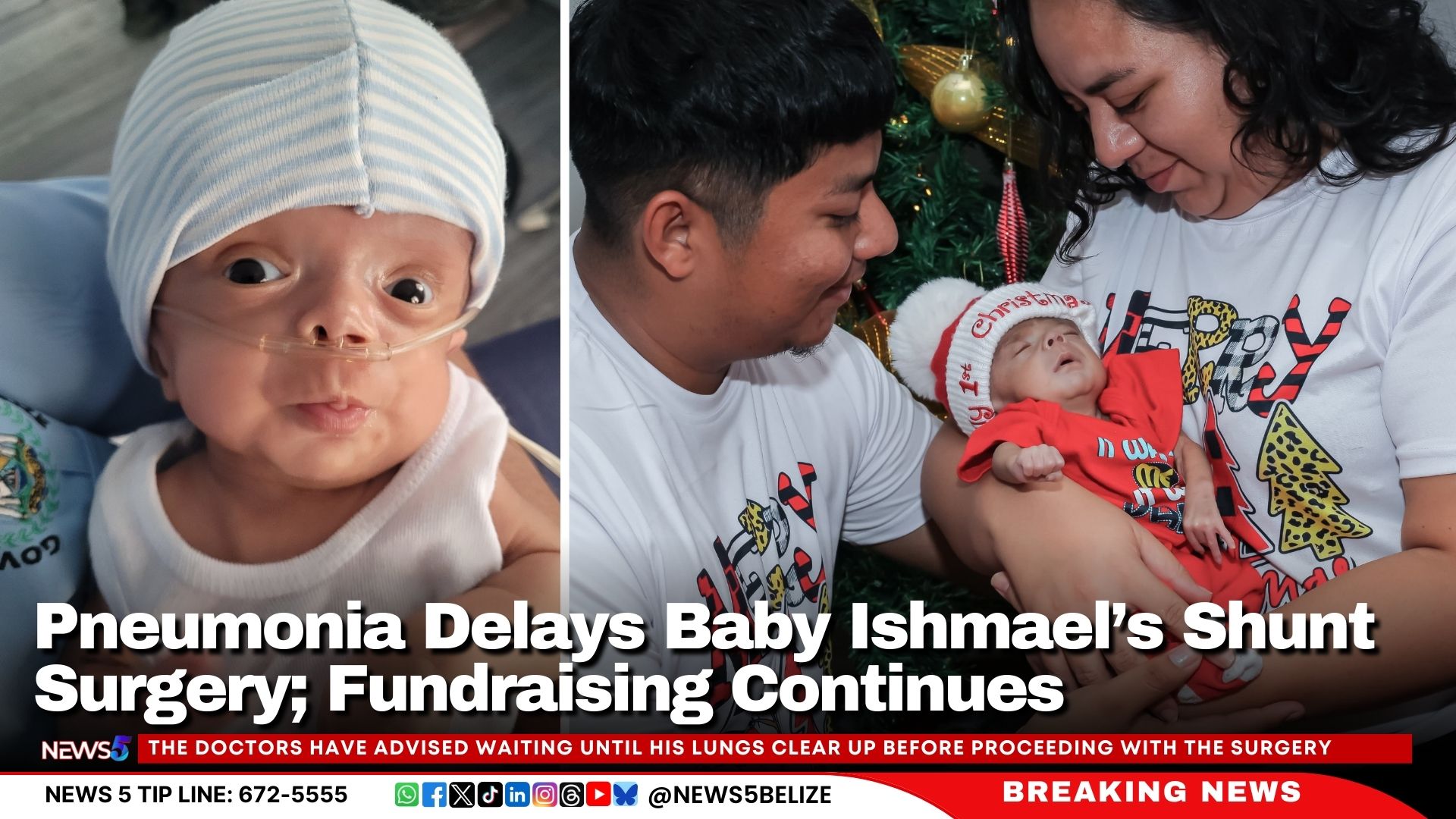 Pneumonia Delays Baby Ishmael’s Shunt Surgery; Fundraising Continues