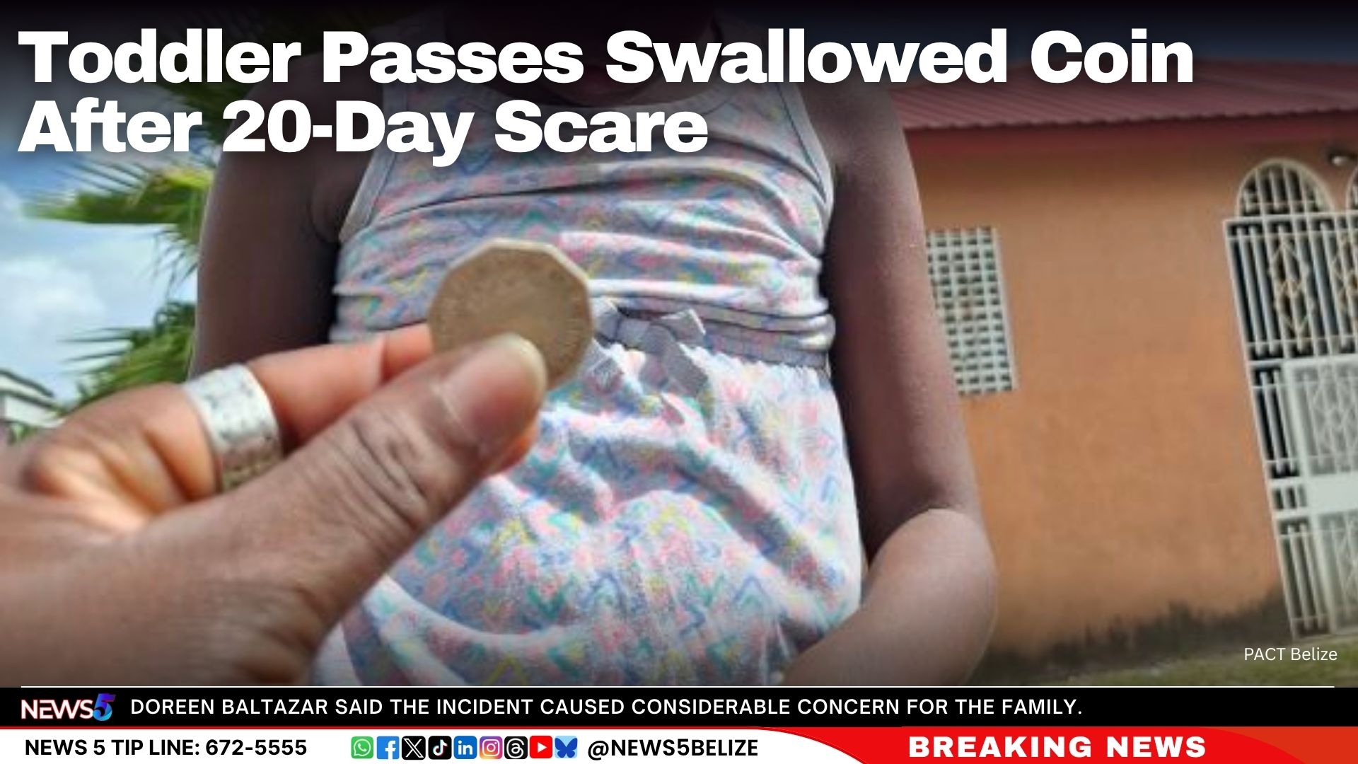 Toddler Passes Swallowed Coin After 20-Day Scare