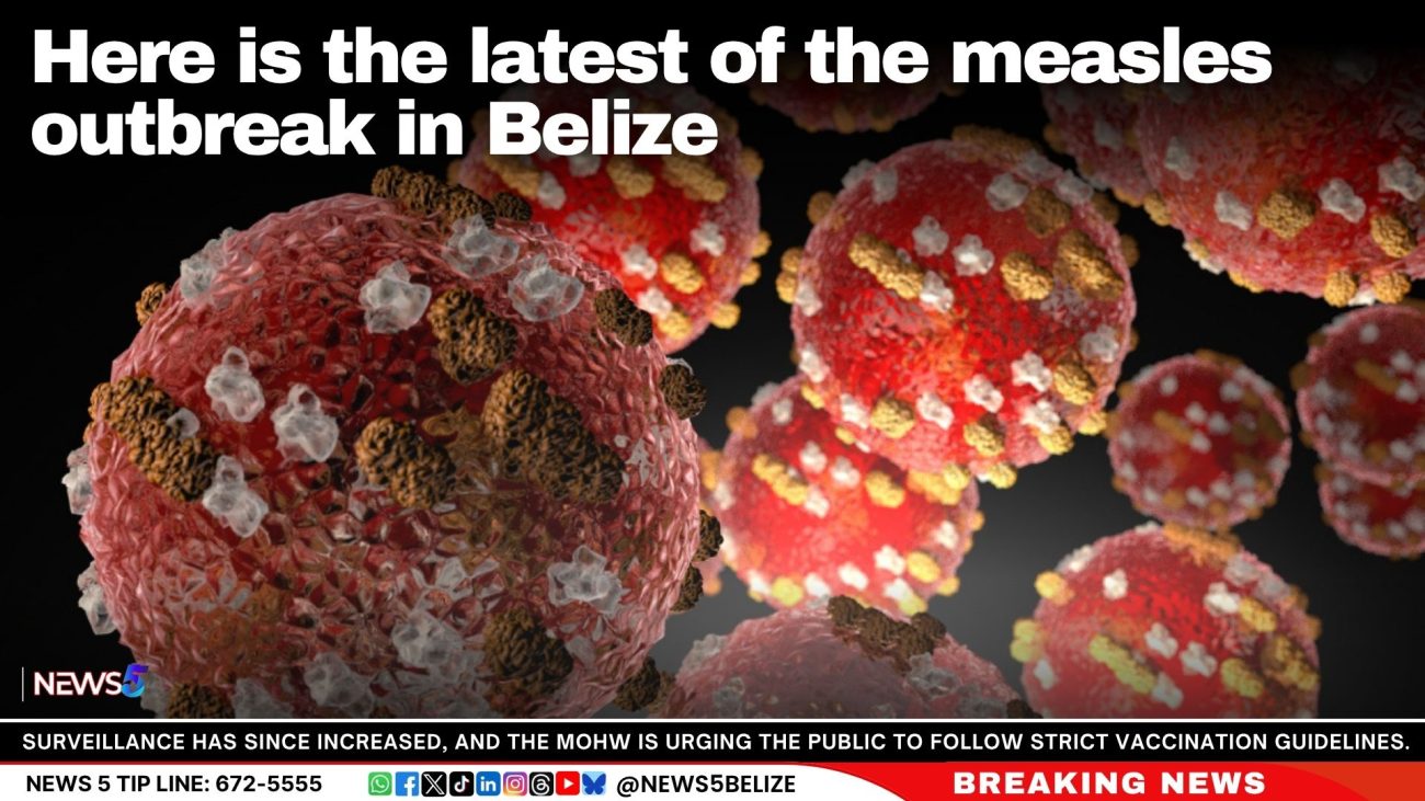 Here is the latest of the measles outbreak in Belize